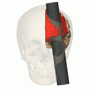 phineas gage