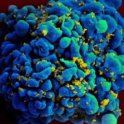 Scanning electromicrograph of an HIV-infected H9 T cell by the NIAID