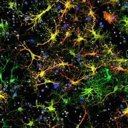 microscopy image of fluorescently tagged astrocytes in shades of green and yellow with red tau proteins