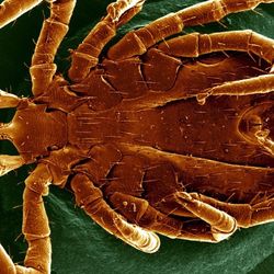 A tick imaged by a scanning electron microscope.