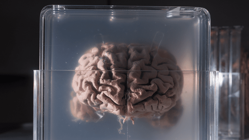 A brain suspended in a jar.