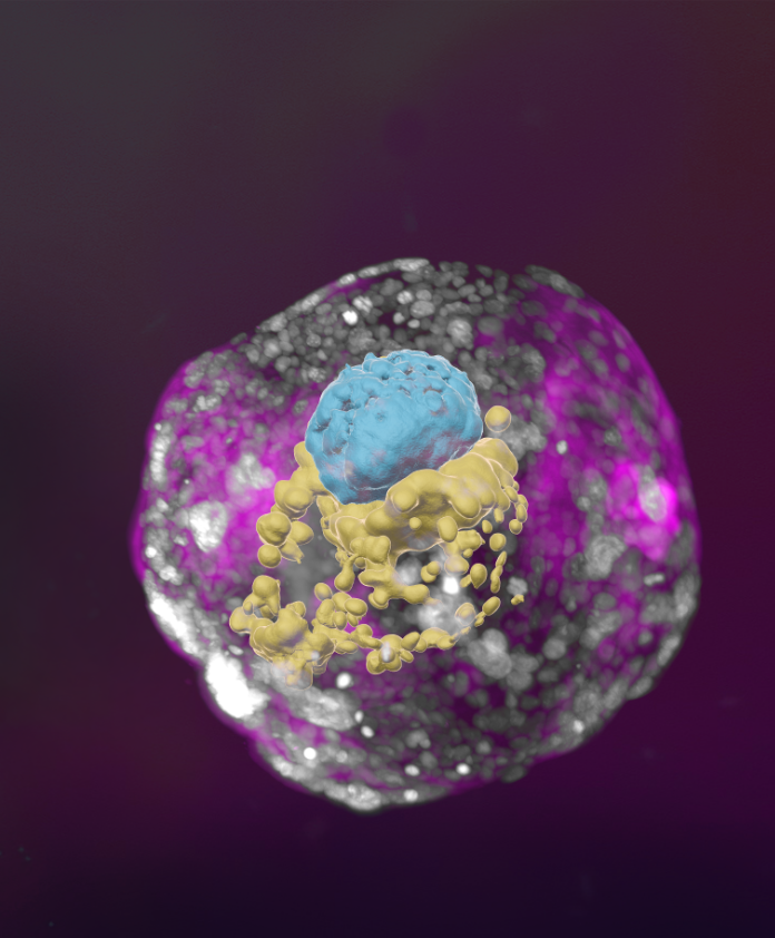 A stem cell–derived human embryo model at a developmental stage equivalent to that of a day 14 embryo. The model has all the compartments that define this stage: the yolk sac (yellow) and the part that will become the embryo itself, topped by the amnion (blue) – all enveloped by cells that will become the placenta (pink)